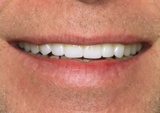 Young man smiling brightly after seeing dentist in Grand Island