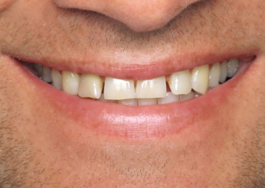 Senior man smiling before visiting Grand Island dentist