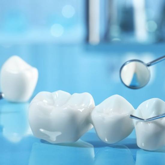 Close up of dental bridge sitting on a blue counter