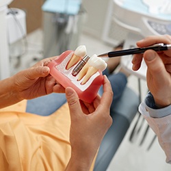 Dentist showing patient model of teeth